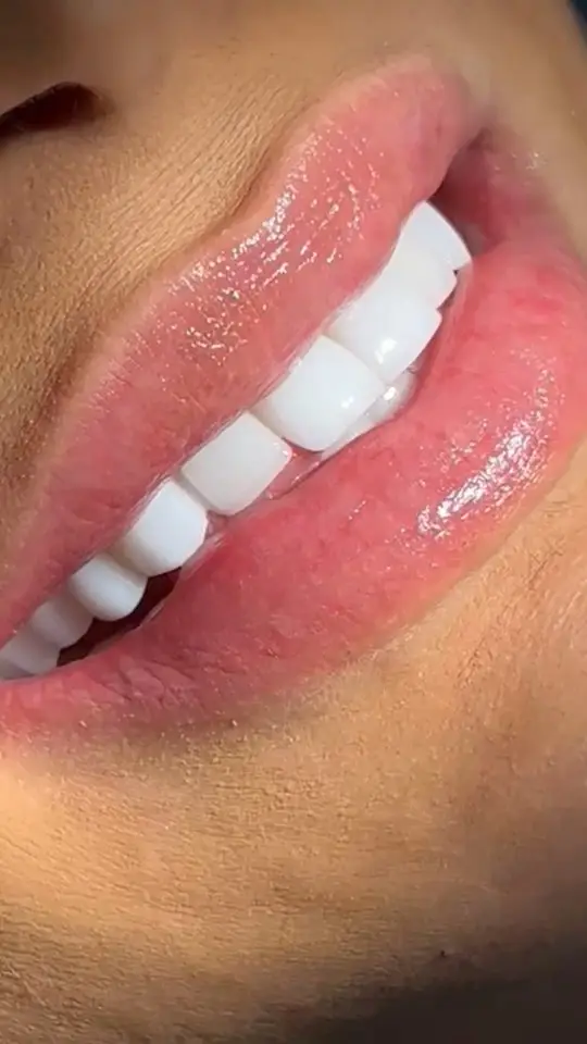 BADRA Dental Clinic — smile results